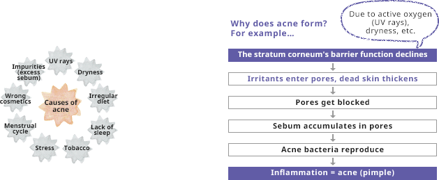 Due to active oxygen(UV rays),dryness, etc.The stratum corneum's barrier function declines Irritants enter pores, dead skin thickens Pores get blocked Sebum accumulates in pores Acne bacteria reproduce Inflammation = acne (pimple)
