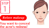 Before makeup You want to conceal the acne's rednes