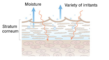 Skin that has dried out and become sensitive